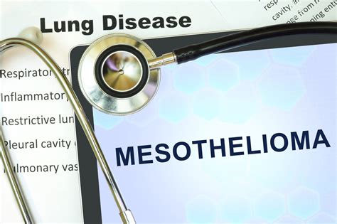 4 New And Promising Treatments For Mesothelioma Todayz News